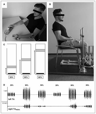 Mirror Electromyografic Activity in the Upper and Lower Extremity: A Comparison between Endurance Athletes and Non-Athletes